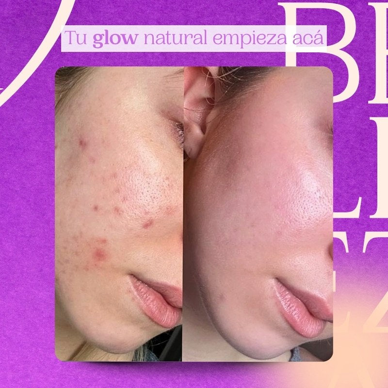 Jabón Facial de Arroz Bioaqua – Limpieza suave, brillo natural