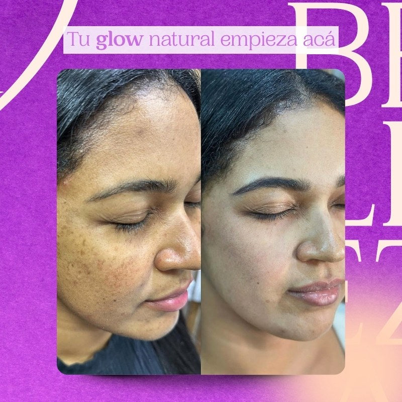 Sérum de Arroz Bioaqua – Hidratación profunda y luminosidad