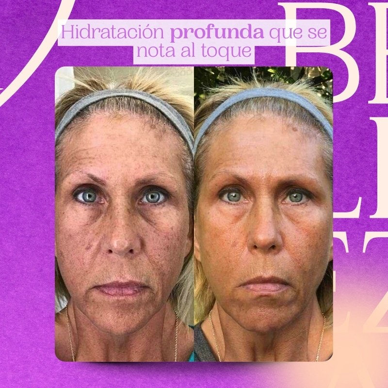 Sérum de Arroz Bioaqua – Hidratación profunda y luminosidad