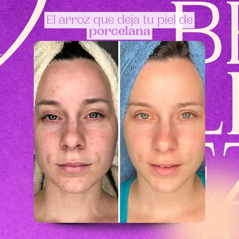 Sérum de Arroz Bioaqua – Hidratación profunda y luminosidad