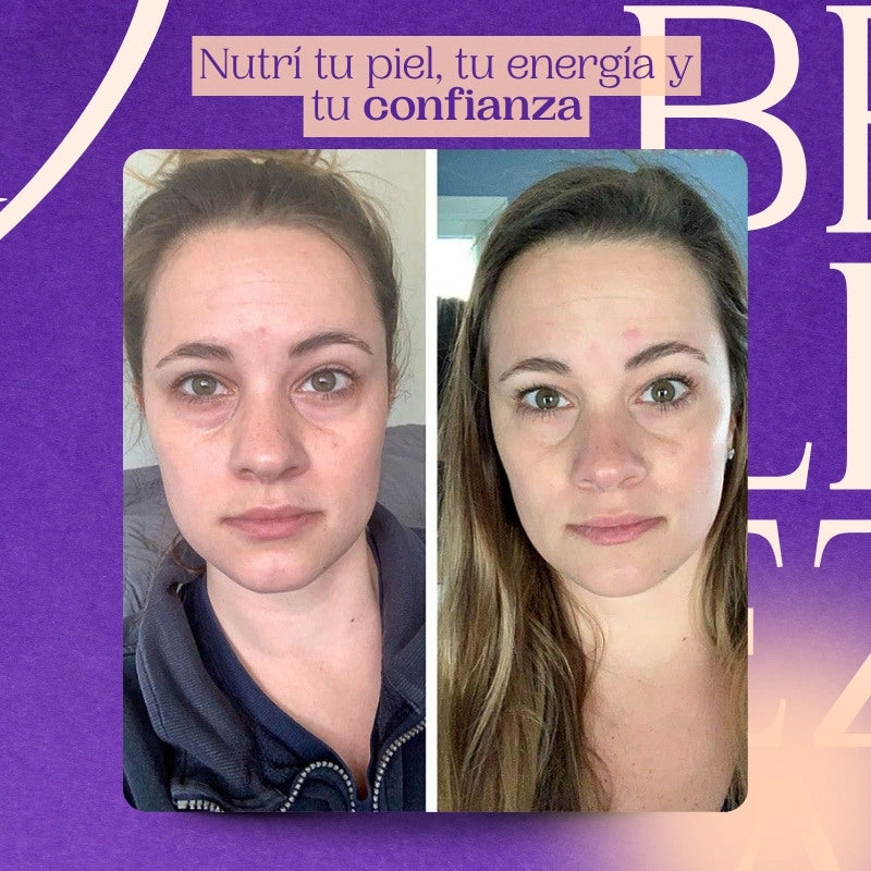 Colágeno + E Bioactivos – Belleza, energía y bienestar