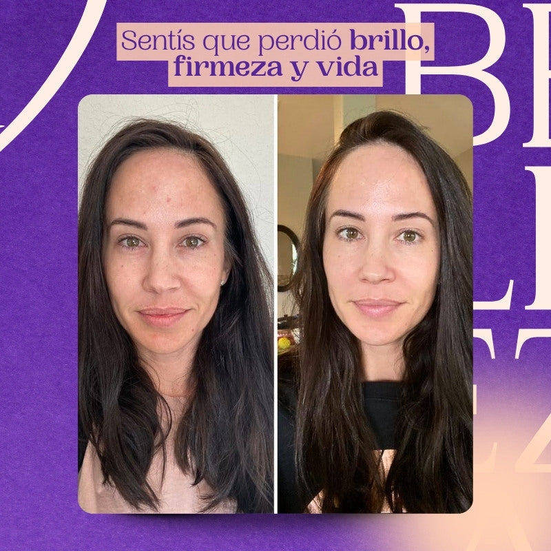 Colágeno + E Bioactivos – Belleza, energía y bienestar
